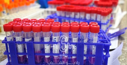 وزارة الصحة تعلن عن تسجيل 10 وفيات و8969 إصابة جديدة بفيروس "كورونا"